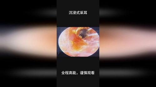 成人耳屎解压视频-第3张图片-午夜成人福利影院 成人耳屎解压视频-第3张图片-午夜成人福利影院